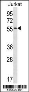 C1RL Antibody (Center)