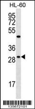 FMR1NB Antibody (N-term)