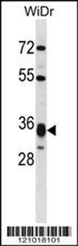 HMGCL Antibody (Center)