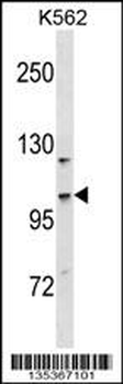CC2D1A Antibody (N-term)