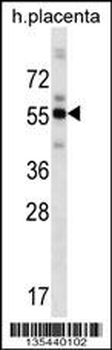 ZBTB8B Antibody (C-term)