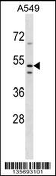 TMEM200A Antibody (N-term)