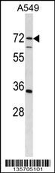 CDADC1 Antibody (C-term)