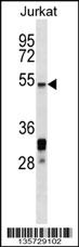 HSF5 Antibody (C-term)