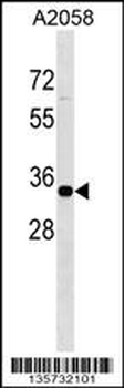 ZNF570 Antibody (Center)