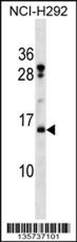 HIST2H2BF Antibody (N-term)