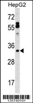 SFTPB Antibody (Center)