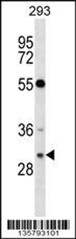 RASD2 Antibody (Center)