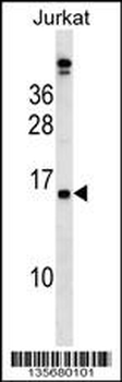 PLAC4 Antibody (N-term)