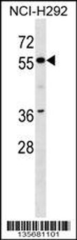ZNF512 Antibody (N-term)