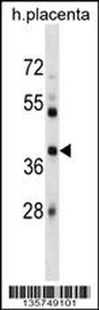 SIAH1 Antibody (Center)