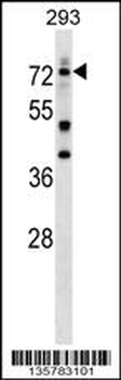 DEAF1 Antibody (C-term)