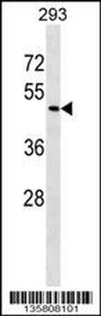ZNF24 Antibody (Center)