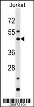 BAG5 Antibody (N-term)