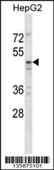 TAPBPL Antibody (N-term)