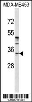 POU6F1 Antibody (N-term)