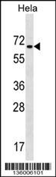ZNF35 Antibody (Center)