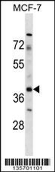 ZAR1 Antibody (Center)