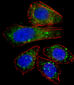 ZNF81 Antibody (N-term)