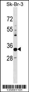 PHYHD1 Antibody (C-term)