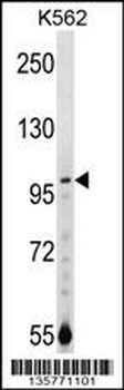 NARG1 Antibody (N-term)