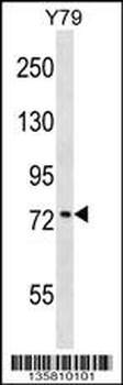 KATNB1 Antibody (Center)