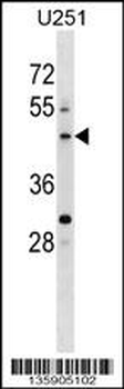 PLEKHO2 Antibody (N-term)
