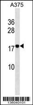 RHOF Antibody (C-term)