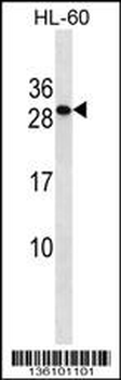 TMED6 Antibody (Center)