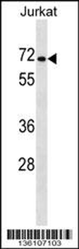 PRODH2 Antibody (Center)