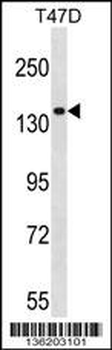 MYO1E Antibody (N-term)
