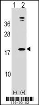 LEP Antibody (N-term)