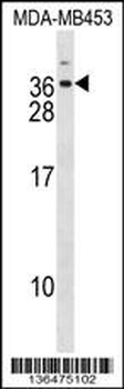 DLX6 Antibody (Center)