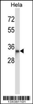 DTNBP1 Antibody (N-term)