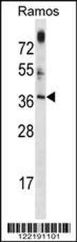 MTG1 Antibody (Center)