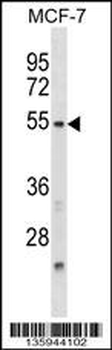 NFIL3 Antibody (N-term)