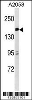 ZBTB38 Antibody (N-term)