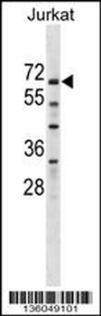 ZNF498 Antibody (Center)