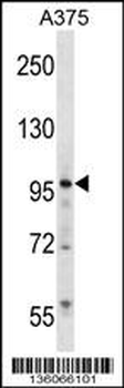 ZNF541 Antibody (Center)
