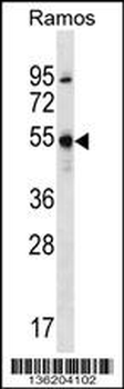 FOXJ2 Antibody (N-term)