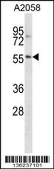 NACC2 Antibody (C-term)