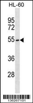 MGAT3 Antibody (C-term)