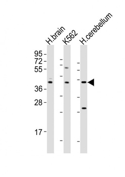 Dopamine D2 receptor antibody
