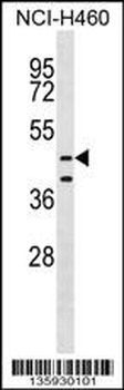 MPND Antibody (N-term)