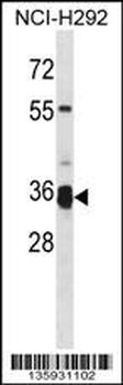 TMPRSS12 Antibody (N-term)