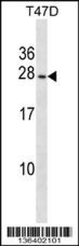 PIGP Antibody (N-term)