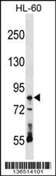 RAVER1 Antibody (N-term)