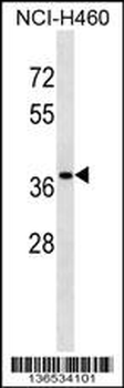 CUTC Antibody (Center)