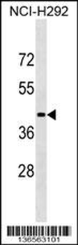 LIPN Antibody (C-term)
