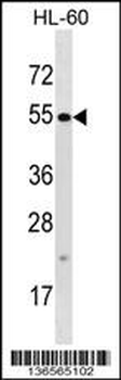 TTC34 Antibody (C-term)